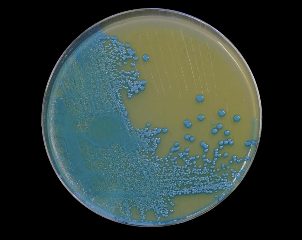 What are Some Types of Bacteria? (with pictures)