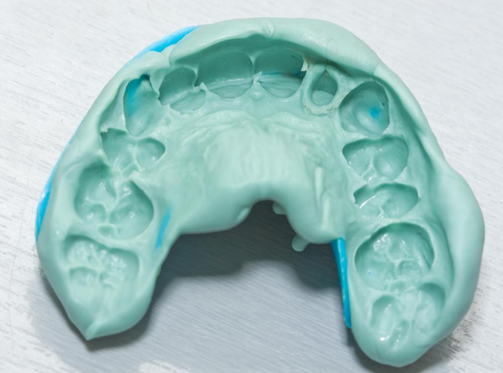 dental impression mass