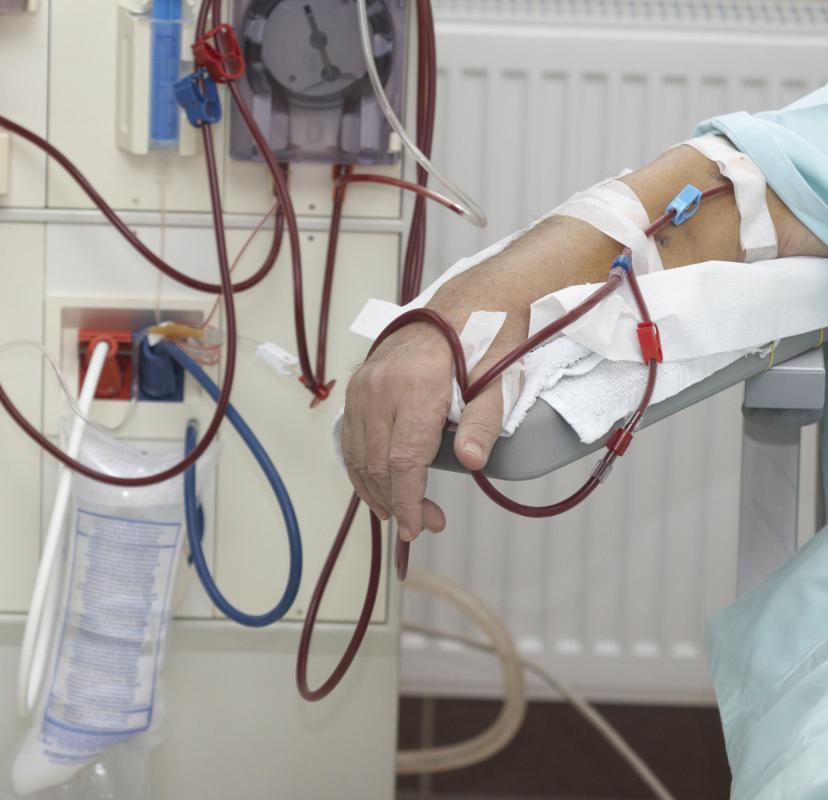 what-is-continuous-ambulatory-peritoneal-dialysis