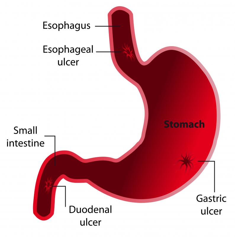 [DIAGRAM] Diagram Of Duodenum - WIRINGSCHEMA.COM