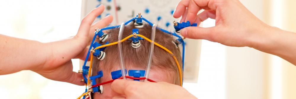 What are the Different Types of EEG Electrodes? (with pictures)