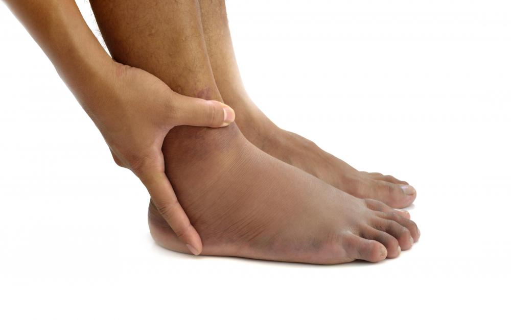 what-are-the-most-common-causes-of-pain-in-the-ball-of-the-foot