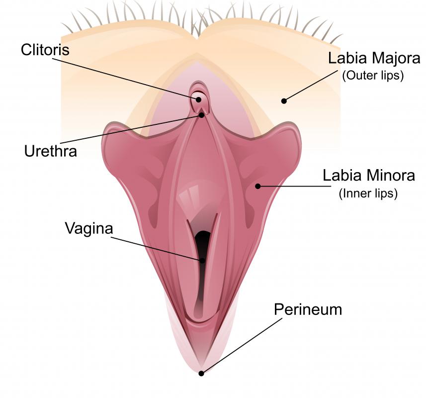 What is a Clitoridectomy? (with pictures)