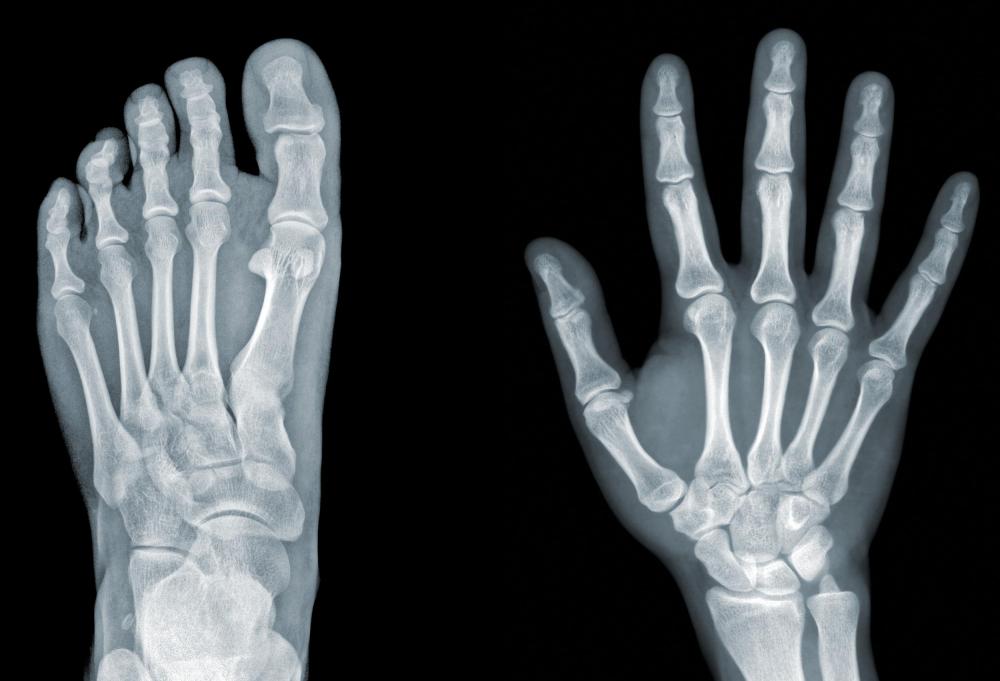 What Is An X Ray Worker with Pictures 