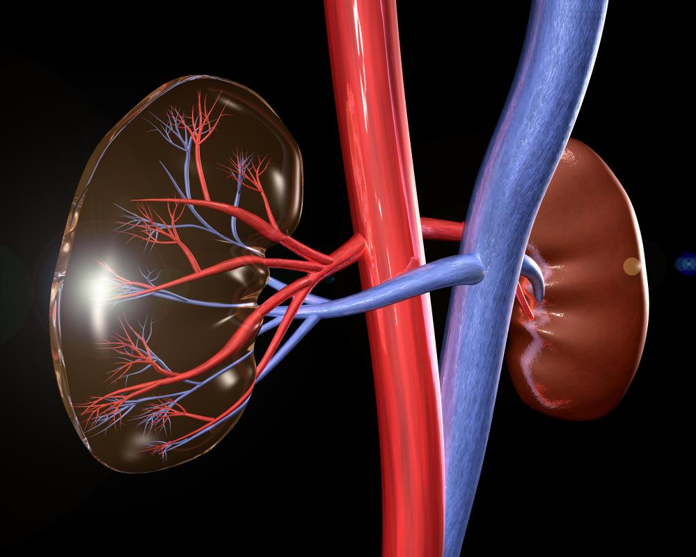 What Causes a Dilated Renal Pelvis? (with pictures)