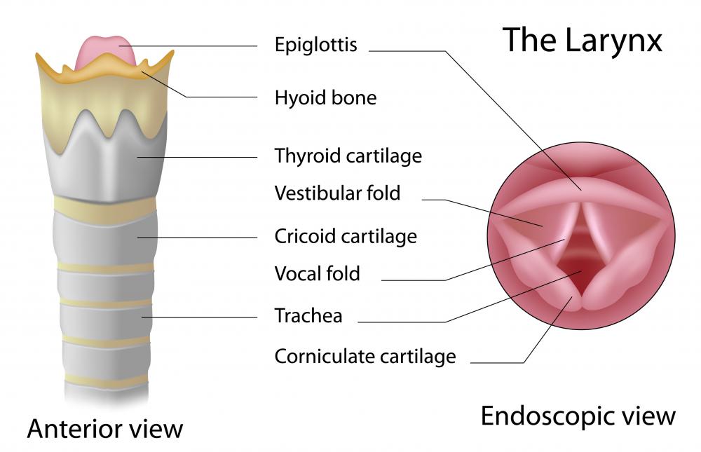 laryngitis diagram