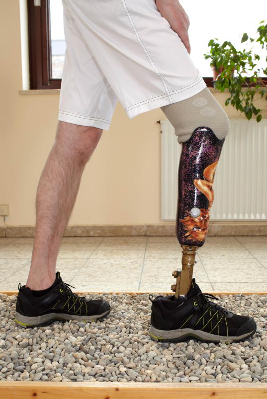 what-is-a-prosthesis-with-pictures