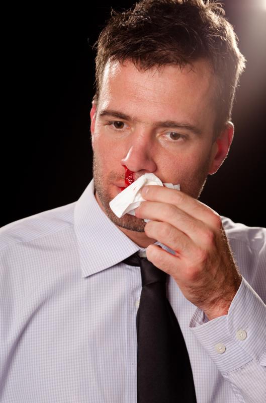 what-are-the-causes-of-frequent-nosebleeds-with-pictures