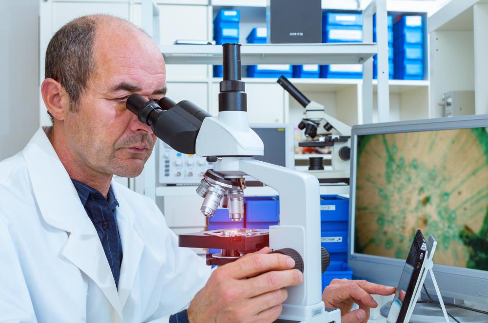 Después de una biopsia, un patólogo puede observar la muestra de tejido bajo un microscopio para asegurarse de que sea benigna.