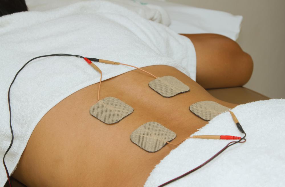 How Do I Choose the Best Electrical Stimulation Devices?