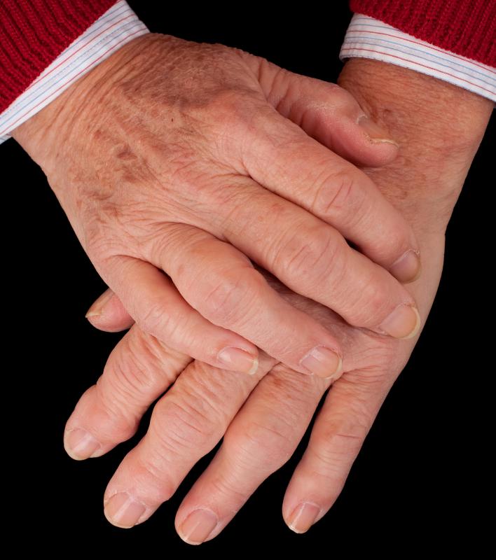 what-are-the-most-common-causes-of-swelling-fingers