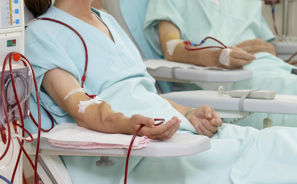 What Is Liver Dialysis With Pictures