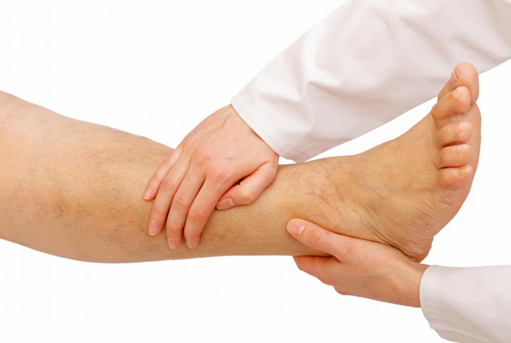 What Causes Pitting Edema In Ankles And Feet