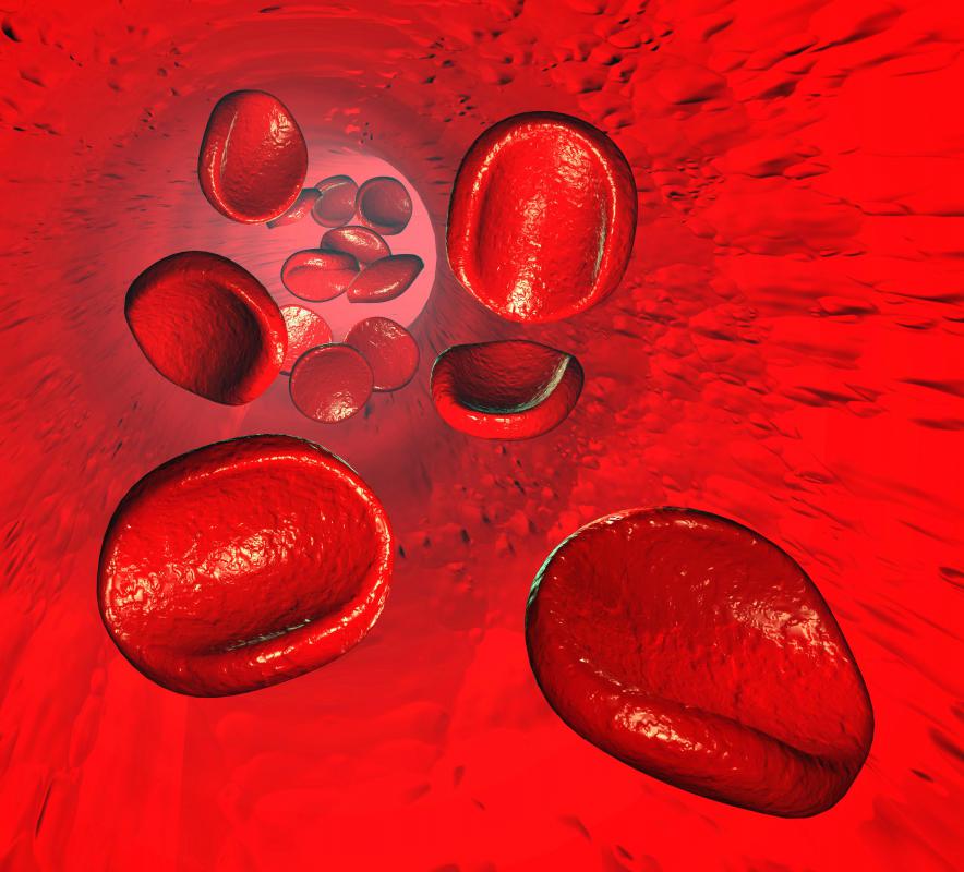 Гемолиз эритроцитов. Гемолизированные эритроциты. Разрушенные эритроциты в крови.