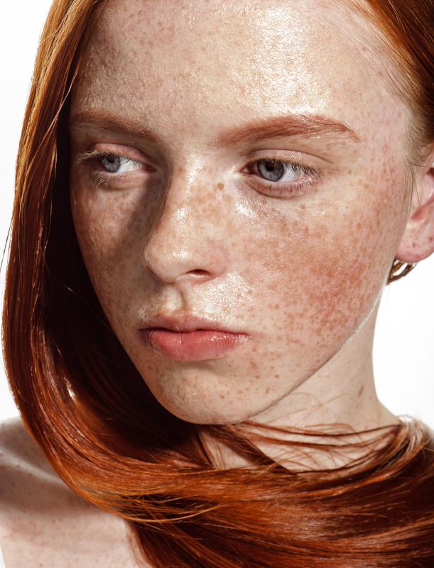 Red Headed Woman With Freckles 