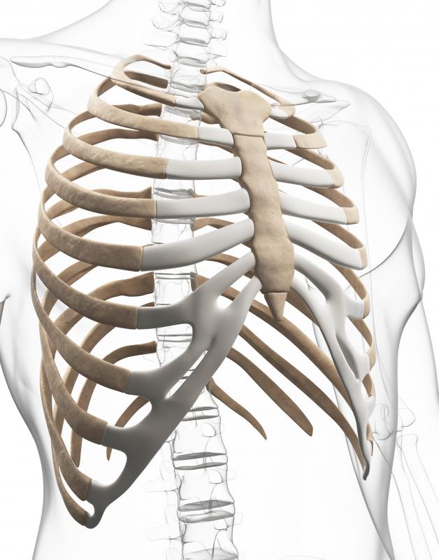 What Causes A Lump On The Sternum With Pictures