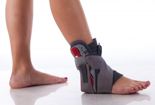 A foot brace will be necessary for a serious sprain or fracture of the ankle or foot.