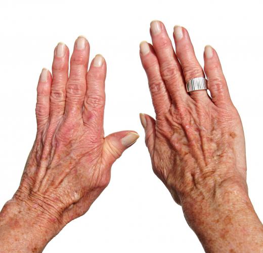 Anti-aging hand cream can lighten dark spots.