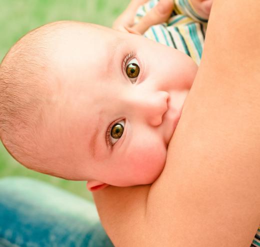 Many children develop cradle cap during infancy.