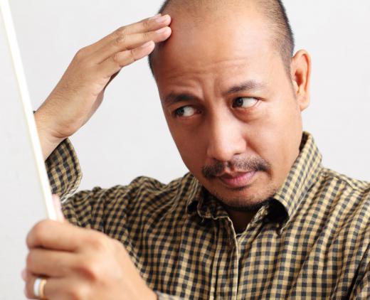 Hair loss is a possible symptom of mixed connective tissue disease.