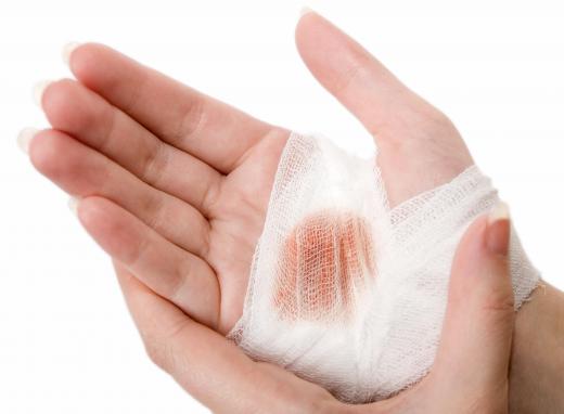 A non-healing wound refers to a wound that has not healed over a proper period of time.