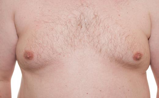 Men with elevated estradiol levels may develop gynecomastia.