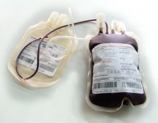 People with aplastic anemia often require blood transfusions.