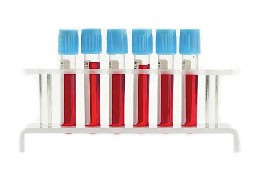 The ELISA test requires a blood sample.