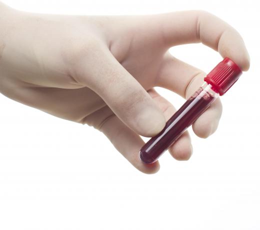 Blood screening tests check for Lyme disease antibodies.