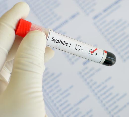 Syphilis can generally be treated with a common antibiotic.