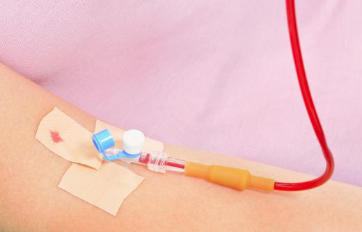 Blood transfusions can be used remedy an iron imbalance in the blood.