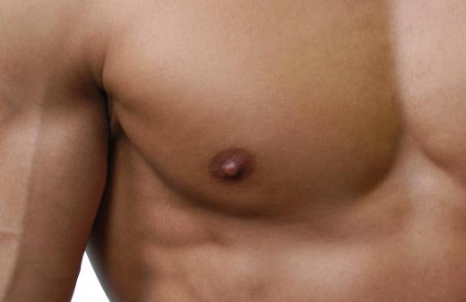 Nipple reduction surgery may be performed on an individual who has an unusually protruding nipple.