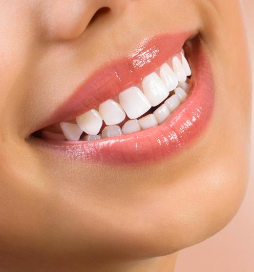 Dental implants can brighten and perfect a person's smile.