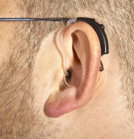 Level of hearing loss is a major factor in choosing a wireless hearing aid.