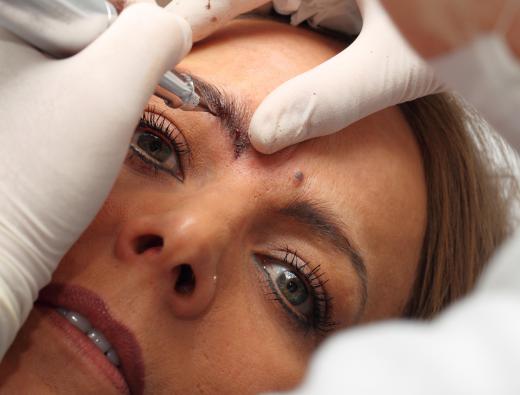 Cosmetic tattooing can be used to permanently shape and color one's eyebrows.