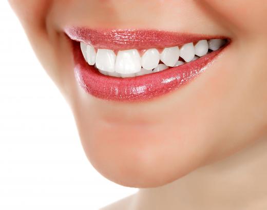 Braces may help achieve straight teeth.