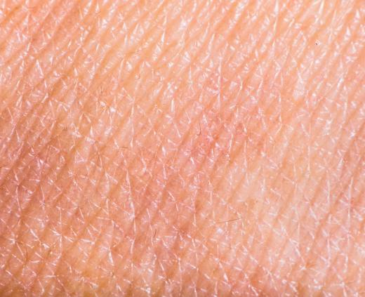 The dermis is below the epidermis, or the top layer of skin.