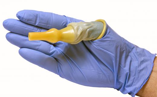 A condom catheter.