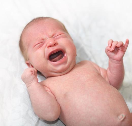 A lactose intolerance may cause bloody stool in babies.