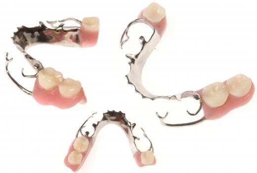 Partial dentures,a type of false teeth.