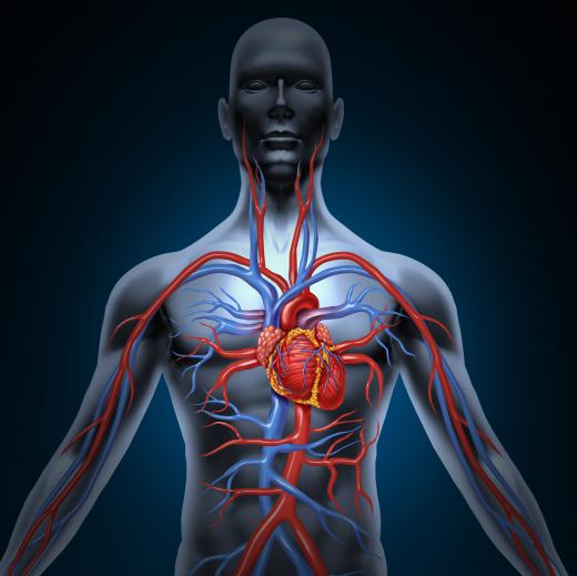 In bypass surgery, the artery is sutured in place beyond the blockage point in the coronary artery.