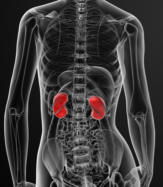 Hyperkalemia typically leads to kidney disfunction.