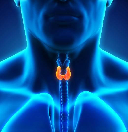 In some cases, struma ovaril may cause an overactive thyroid gland.