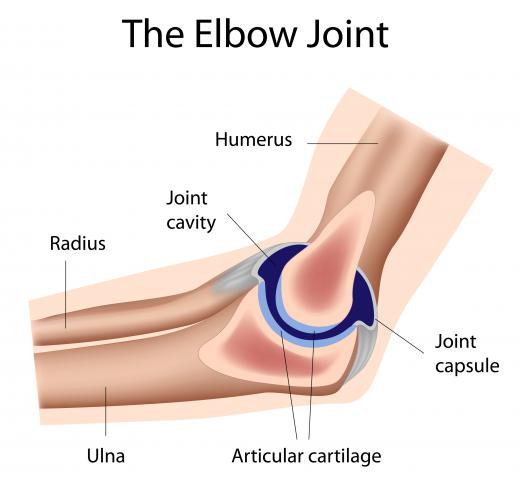 The elbow joint, showing the radius and ulna. Torus fractures often affect one of these two bones.