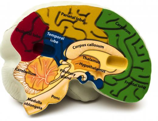 Dyskinetic cerebral palsy arises from damage to the brain's basal ganglia and cerebellum.