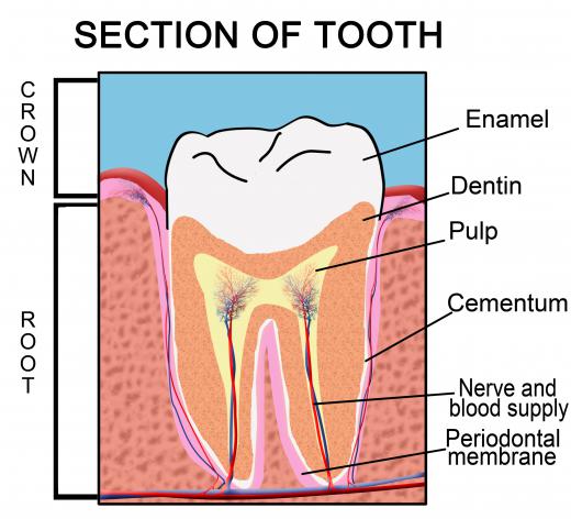 The parts of a tooth. Pulpitis is an inflammation of the pulp.