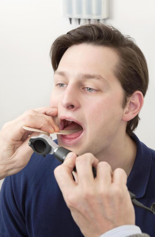 To properly diagnose sleep apnea, a doctor will examine a patient's mouth and throat for evidence of extra or large tissues.