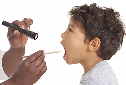 A throat culture is generally performed to determine if scarlatina is present.