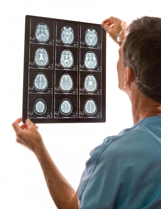 MRI scans help physicians diagnose brain tumors.