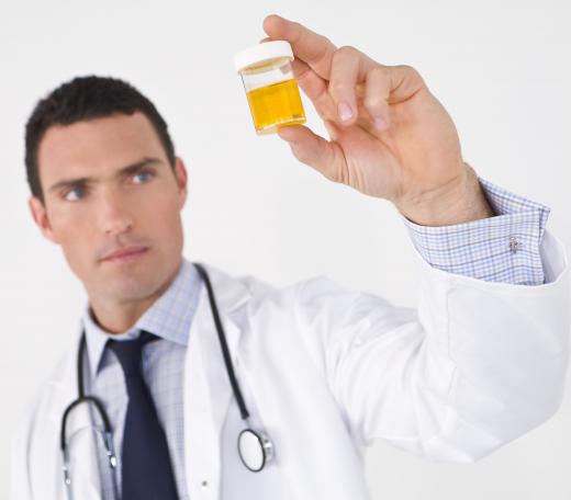 A urinalysis can detect excess acidity in the body.